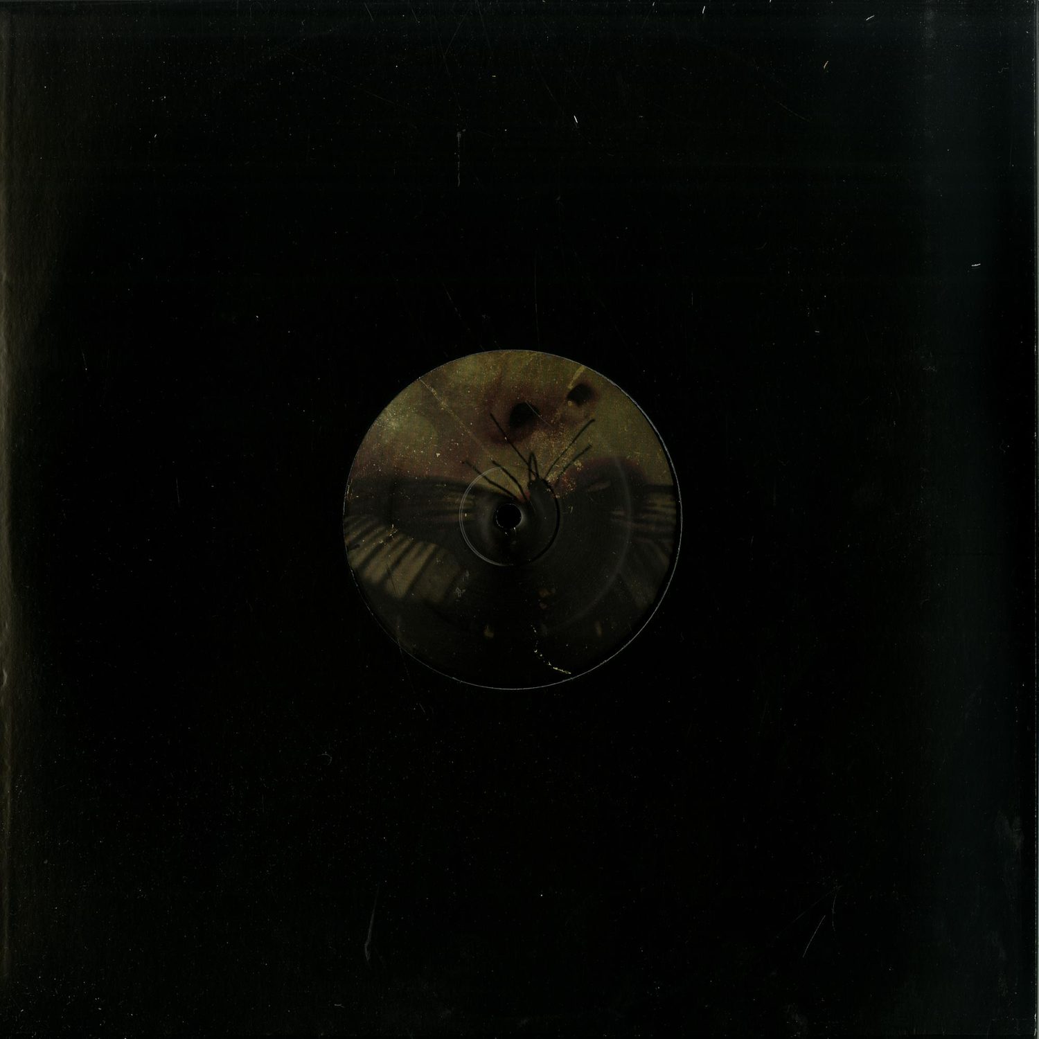 Rebekah - ANXIETY