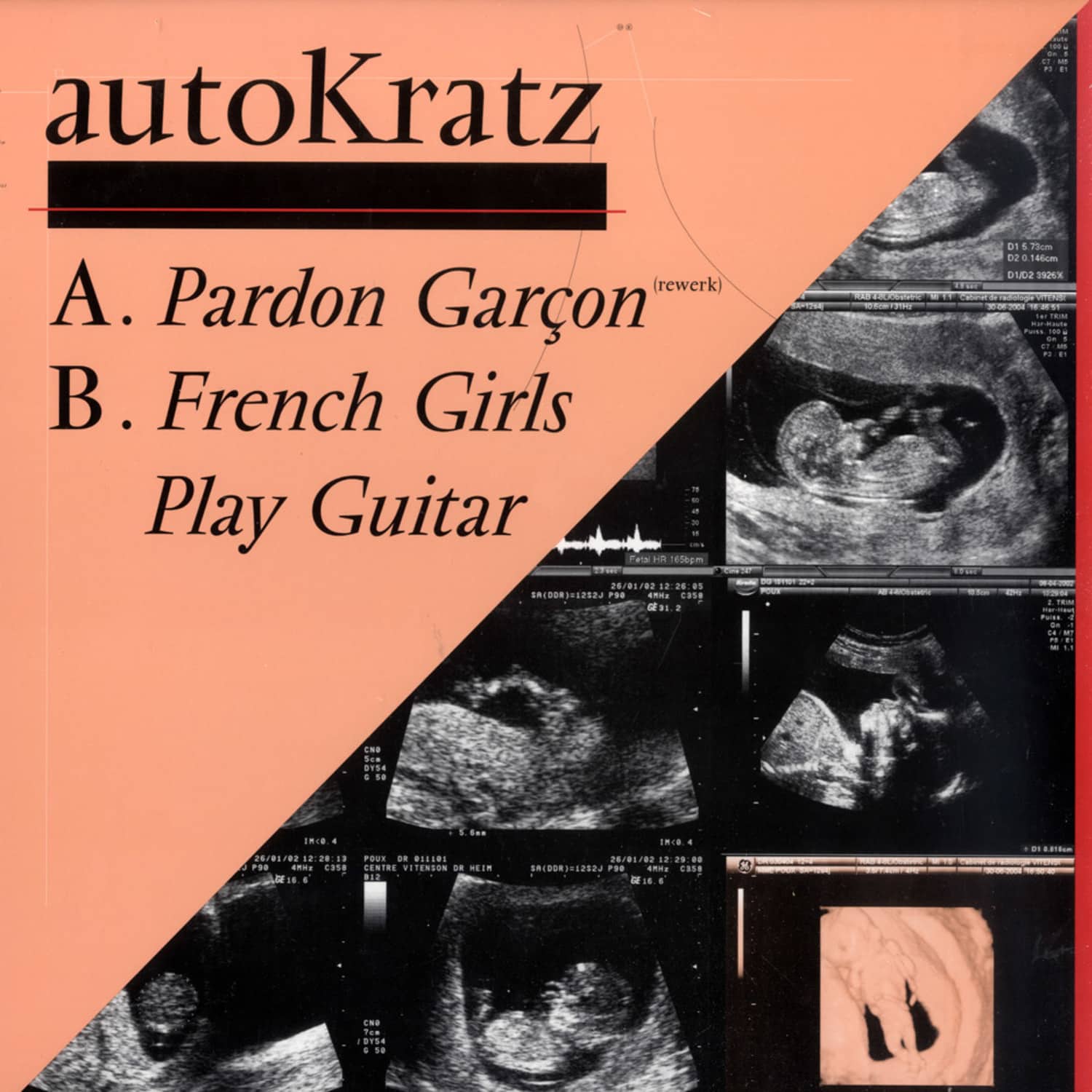 autoKratz - Pardon Garcon / French Girls