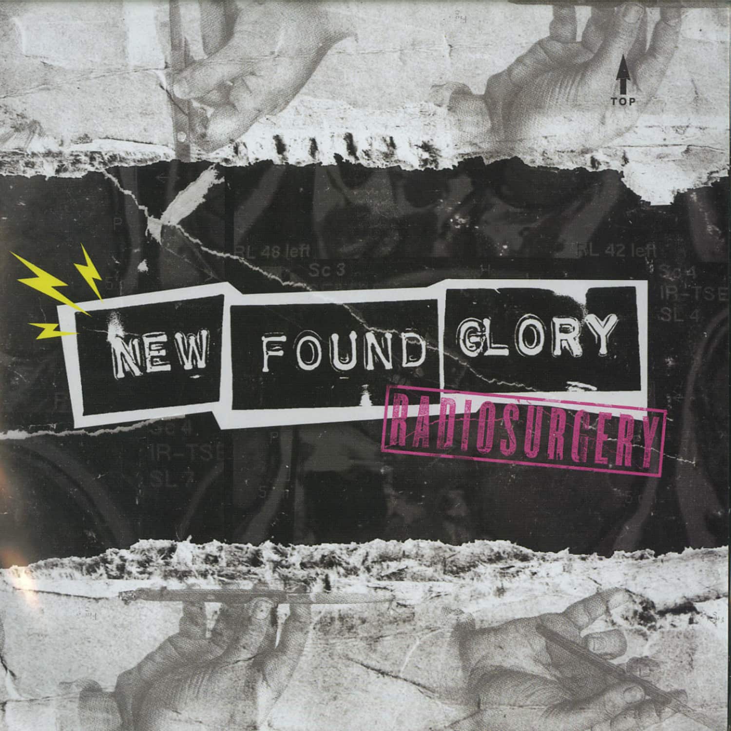 New Found Glory - RADIOSURGERY 