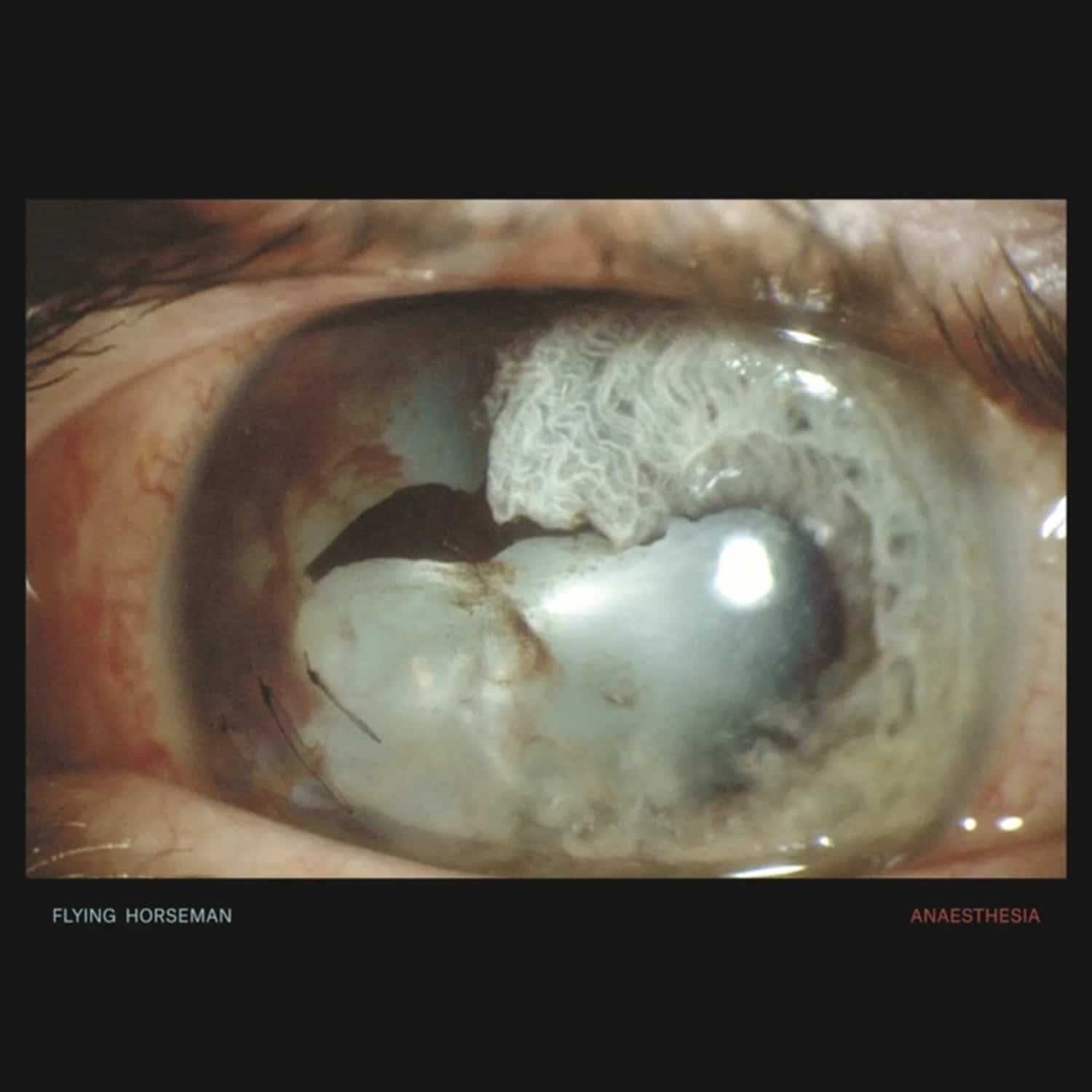 Flying Horseman - ANAESTHESIA 