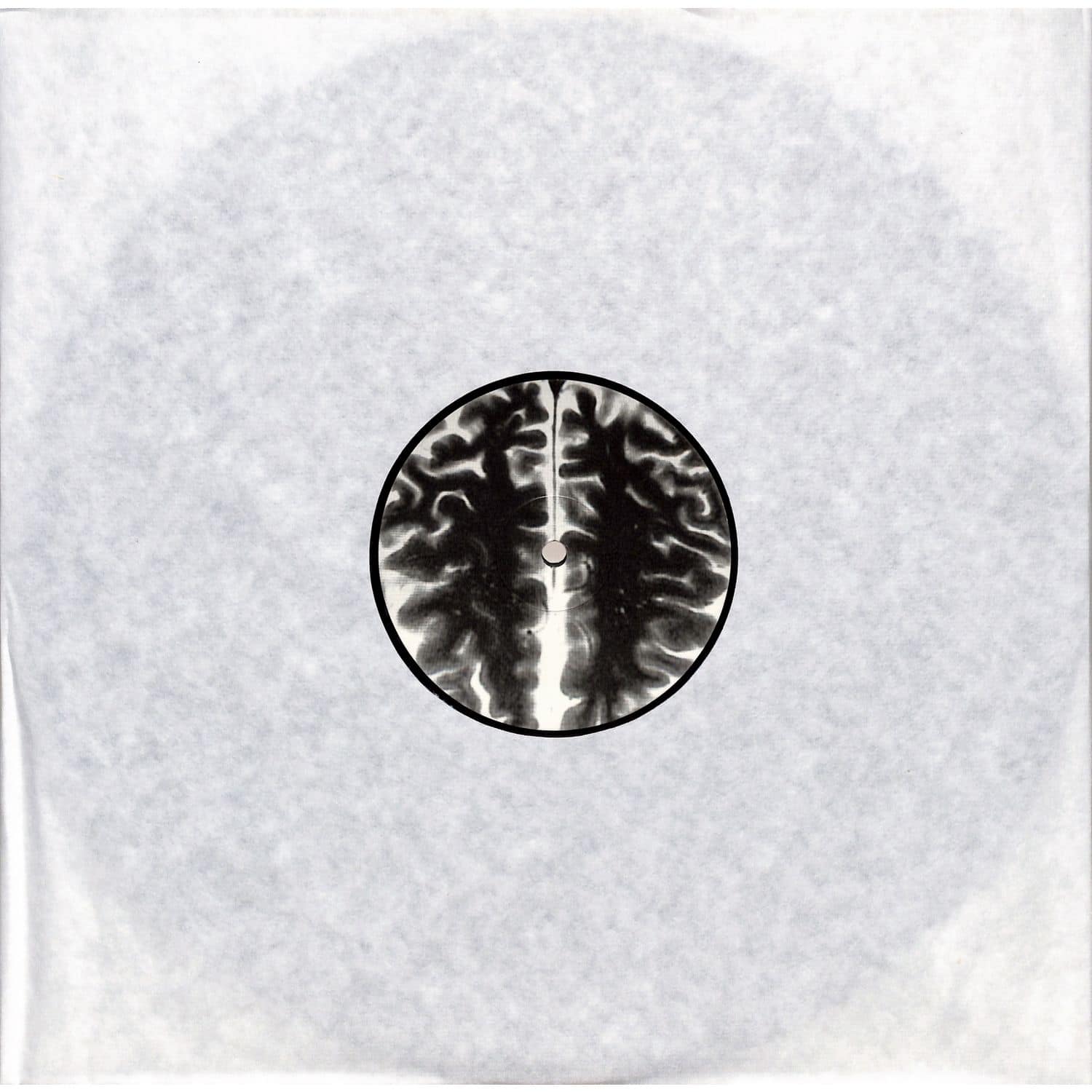 Alinep - SIPA EP
