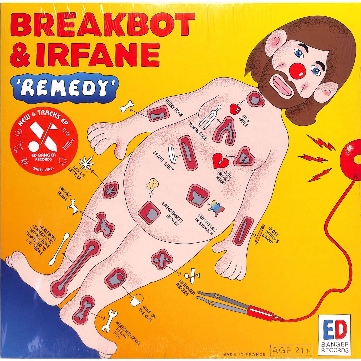 Breakbot Irfane - REMEDY 