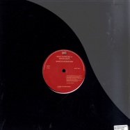 Back View : Music Hazard Inc vs Mathplanete - SHAKE YOUR BRAIN REMIX - Whist Records / WHIST002